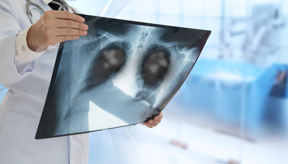 BioNTech'ten akciğer kanseri ilacı: Tümörlerde yüzde 30 küçülme sağladı
